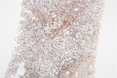 H20230246網(wǎng)織X100-1