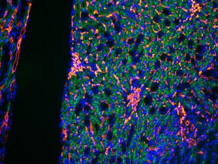 正置八孔LED熒光附件FL8-BGU-MH (1)