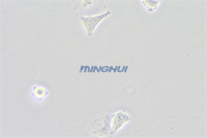 倒置顯微鏡MHIL200和MHD600相機應用于食管鱗癌觀察（中山大學）