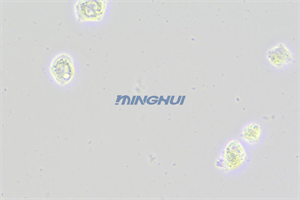 倒置顯微鏡MHIL200和MHD600相機應用于食管鱗癌觀察（中山大學）