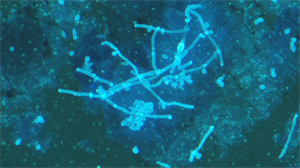 明慧熒光顯微鏡助力廣西自貿(mào)區(qū)醫(yī)院用于真菌熒光觀察